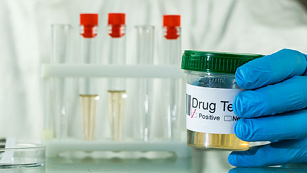 drug and alcohol test